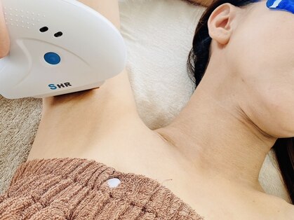 シュエット(CHOUETTE)の写真
