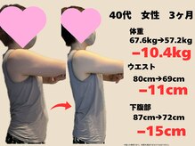 樹美容鍼灸整体院 烏丸御池/４０代 ３ヶ月コース