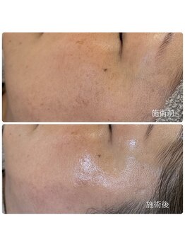 チョチョワンプラス(緒々one+)/満足度、変化量◎プレミアム