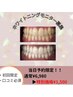 【ご新規様限定】ホワイトニングモニター♪