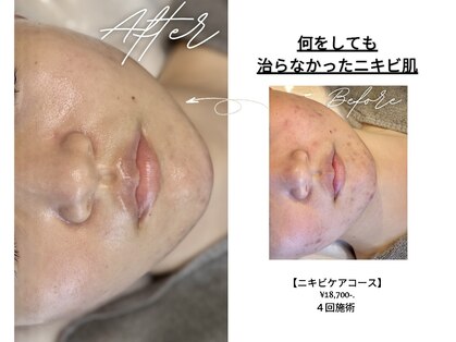キュレイテッドスキン(CURATED SKIN)の写真