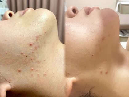 サエラ(SAERA)の写真
