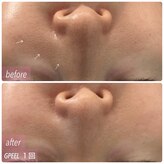 トータルビューティサロン リボーテ(Re:Beaute)