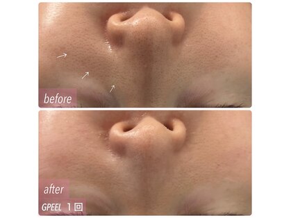 トータルビューティサロン リボーテ(Re:Beaute)の写真