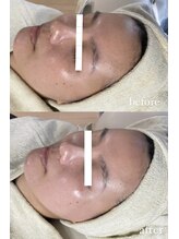 ミーミドットアイ(Mi-mi.i)/艶肌フェイシャルワックス