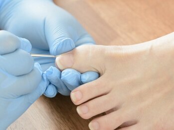 エルユーネイルズ(LUnails)の写真/≪日本トラブルネイルケア協会認定資格≫巻き爪/二枚爪/変形/変色etc…爪のお悩みお任せください◎