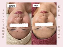 ルア(LuA.)/スキンケアの重要性☆☆☆