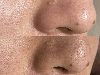 エピファニー(Epi phany Total Beauty Salon)の写真