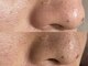 エピファニー(Epi phany Total Beauty Salon)の写真