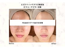 サロン ド マハロ(Salon de MAHALO)の雰囲気（エステティックプラズマで小顔と細胞レベルお肌ケア！）