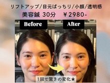 松山鍼灸マッサージ院
