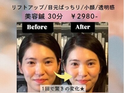 松山鍼灸マッサージ院の写真