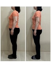 マナ(mana)/運動なしでここまで変身！