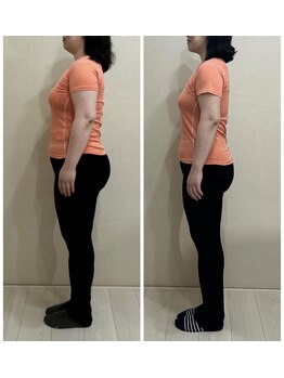 マナ(mana)/運動なしでここまで変身！