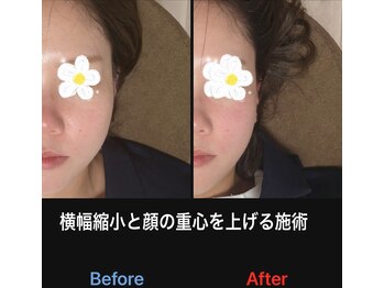 美容矯正サロン レレポノ(LELEPONO)/