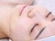 ナーナモエ(na-namoe)の写真/くすみ・顔色の暗さを根本から整え、透明感とツヤあふれるお肌へ導く本格肌質改善フェイシャル