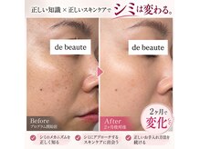 ドゥ ボーテ(de beaute)の雰囲気（絶賛！オーナー自身シミケアプログラム実施中♪）