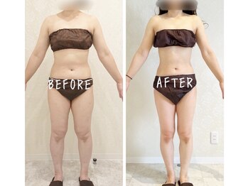 デジール(DESIR)/半年で驚愕のサイズダウン！