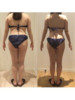 アユアランリンク 札幌中島公園店/C様：背面