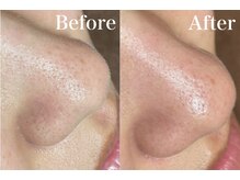 フフラバイプラス(FUFLA BY PLUS)/毛穴洗浄