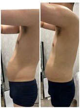 ルミネル 名古屋新栄(Luminelle)/反り腰　姿勢改善