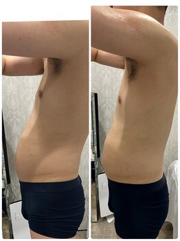 ルミネル 名古屋新栄(Luminelle)/反り腰　姿勢改善