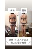 【不眠/不調/むくみ改善】痩リンパデトックストリートメント120分
