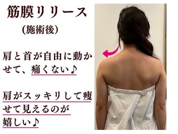トータルセラピー リッチ(Rich)/宮崎市 肩こり