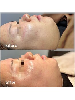 シェリール(cherir)/