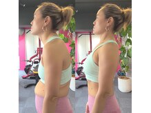 姿勢で見た目は変わる!!巻き肩 猫背 スマホッ首 は改善できます!