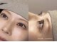 サロン チアリス(salon chiariss)の写真