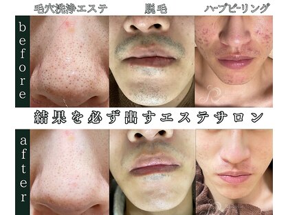 メンズミーシェ(Men's Meshie)の写真