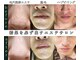 メンズミーシェ(Men's Meshie)の写真