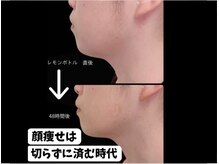 芹花 鹿の子台 (SERIKA)