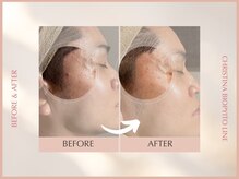 シンスプラス(SINCE+)/【メンズ専用】クリスティーナ