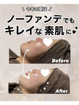 ビレボ マエバシ(BEREVO maebashi)/Before After