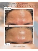 トイロ(toiro)/炭酸パック