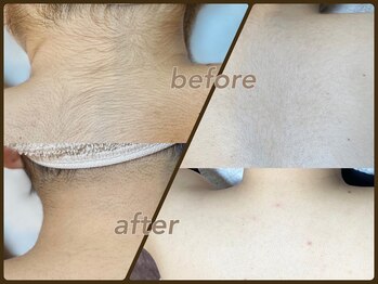 フルーブラン(Frubran)/【女性】45分好きな部位打ち放題