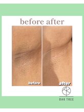 オークツリー(oak tree)/Before After