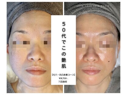 キュレイテッドスキン(CURATED SKIN)の写真