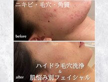 リモアボーテ(RIMOA beaute)