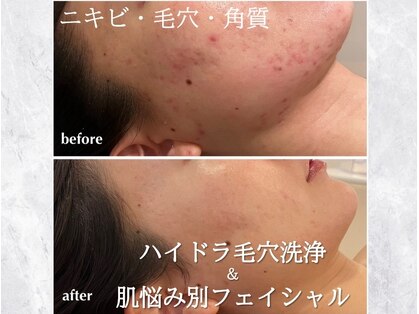 リモアボーテ(RIMOA beaute)の写真