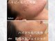 リモアボーテ(RIMOA beaute)の写真