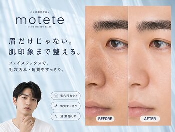 モテテ 池袋店(motete)の写真/フェイスワックスと小鼻くろずみケアで毛穴・角質まで整う清潔肌へ