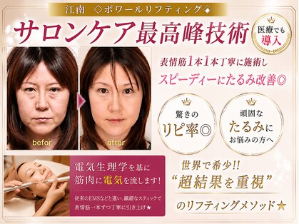 アンジュマリーの写真