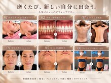 アイディー(Id)