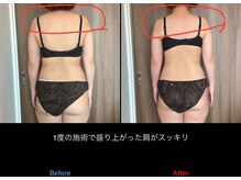 カオン(Kaon)/姿勢矯正で肩周りもスッキリ