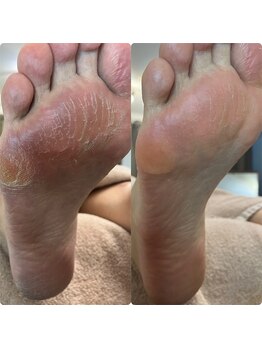 メグムサロン(Megumu Salon)/足つぼ/角質/空ルート整体