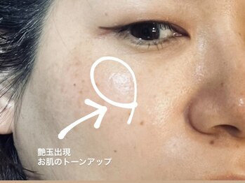 ハリウッドブロウリフト ワクシー 青山店(HOLLYWOOD BROW LIFT WAXYYY.)/ハイドラワンで毛穴洗浄すると