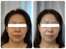 ティアス(t-us)/【肌育】タラソトリートメント